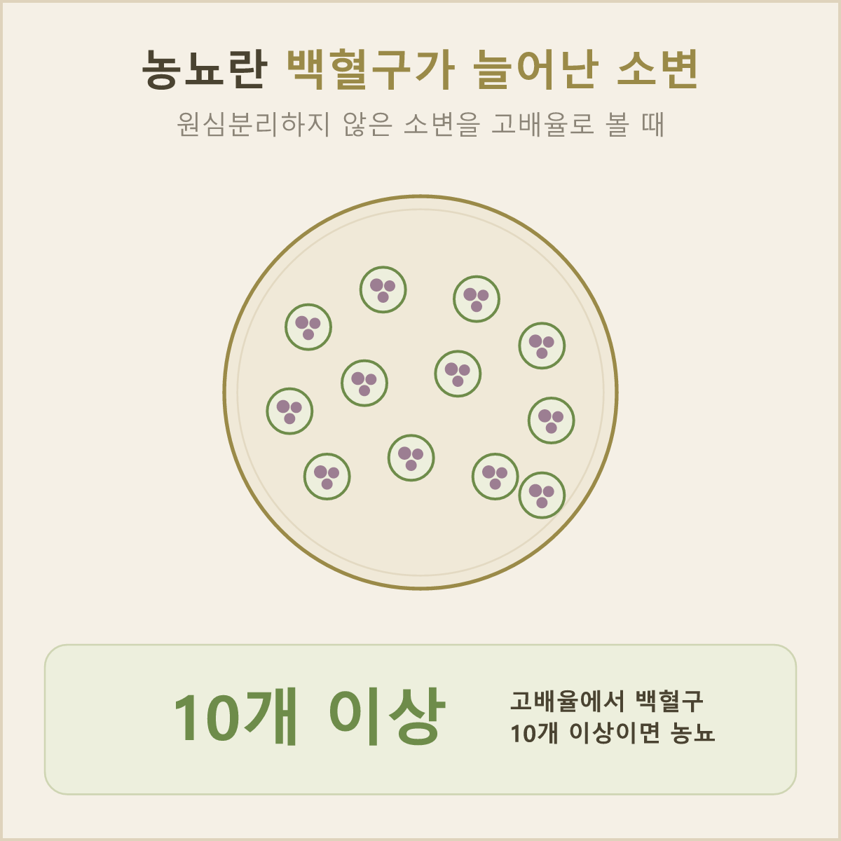 원심분리하지 않은 소변을 고배율로 들여다봤을 때 백혈구가 10개 이상 보이면 농뇨로 봐요