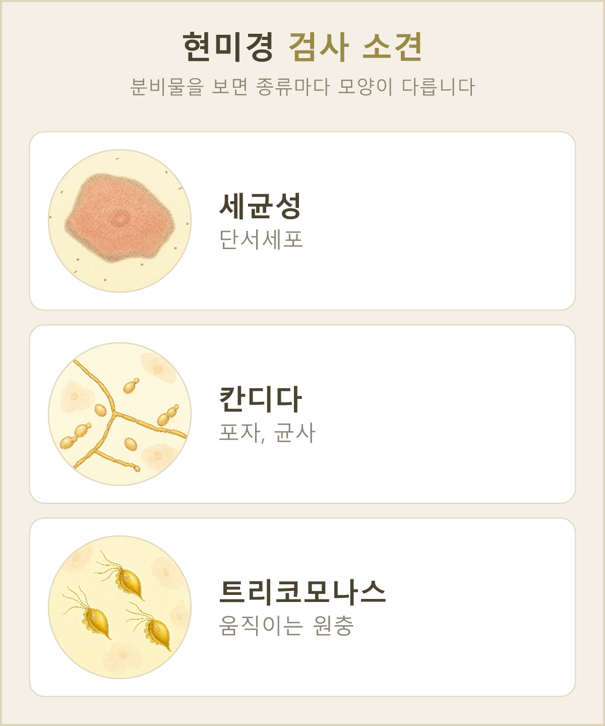 현미경으로 보이는 세균성 질염의 단서세포, 칸디다의 포자와 균사, 트리코모나스 원충