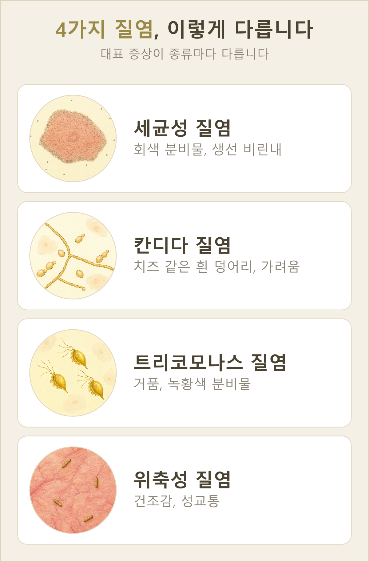 세균성·칸디다·트리코모나스·위축성, 4가지 질염이 서로 어떻게 다른지 한눈에 비교했어요